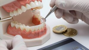 Установка керамического винира и символы оплаты, отражающие стоимость закрытия диастемы в Москве